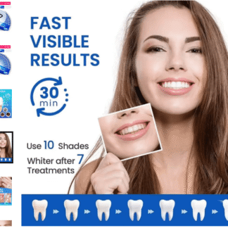 AliExpress-Teeth whitening pen or kit