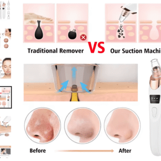 AliExpress-Blackhead remover vacuum